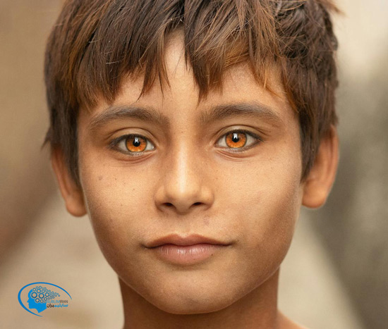 بیوکنزی چشم عسلی