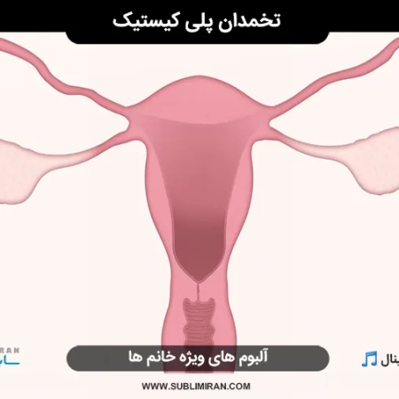 تخمدان پلی کیستیک