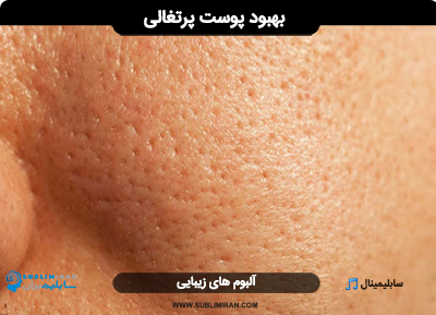 درمان پوست پرتغالی